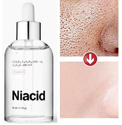Niacinamide Face Serum