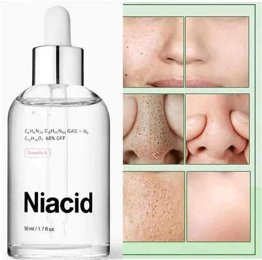 Niacinamide Face Serum