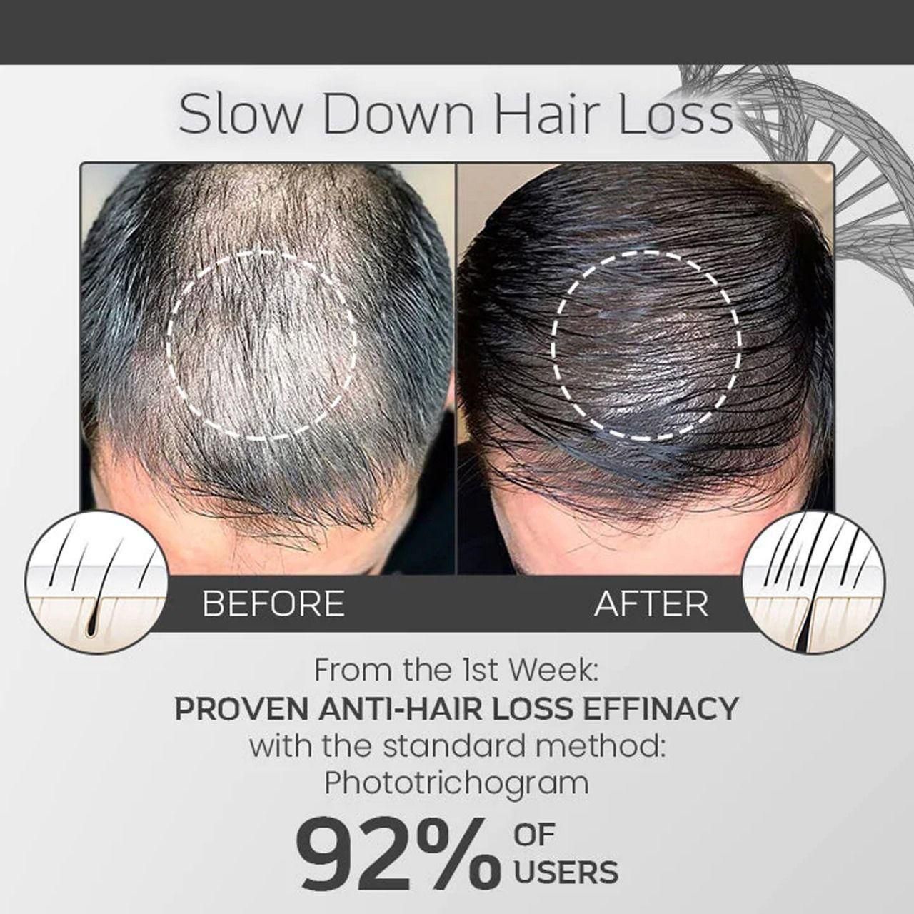 SheddStop Pro-Strength Hair Spray